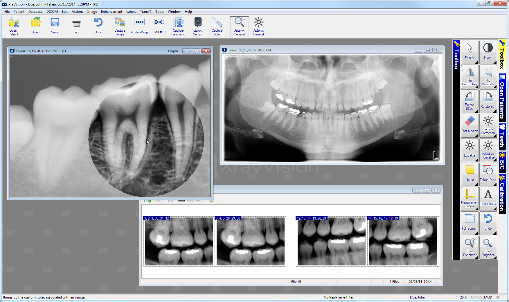 Apteryx Xrayvision Dental Imaging Software Dentalsensors Com