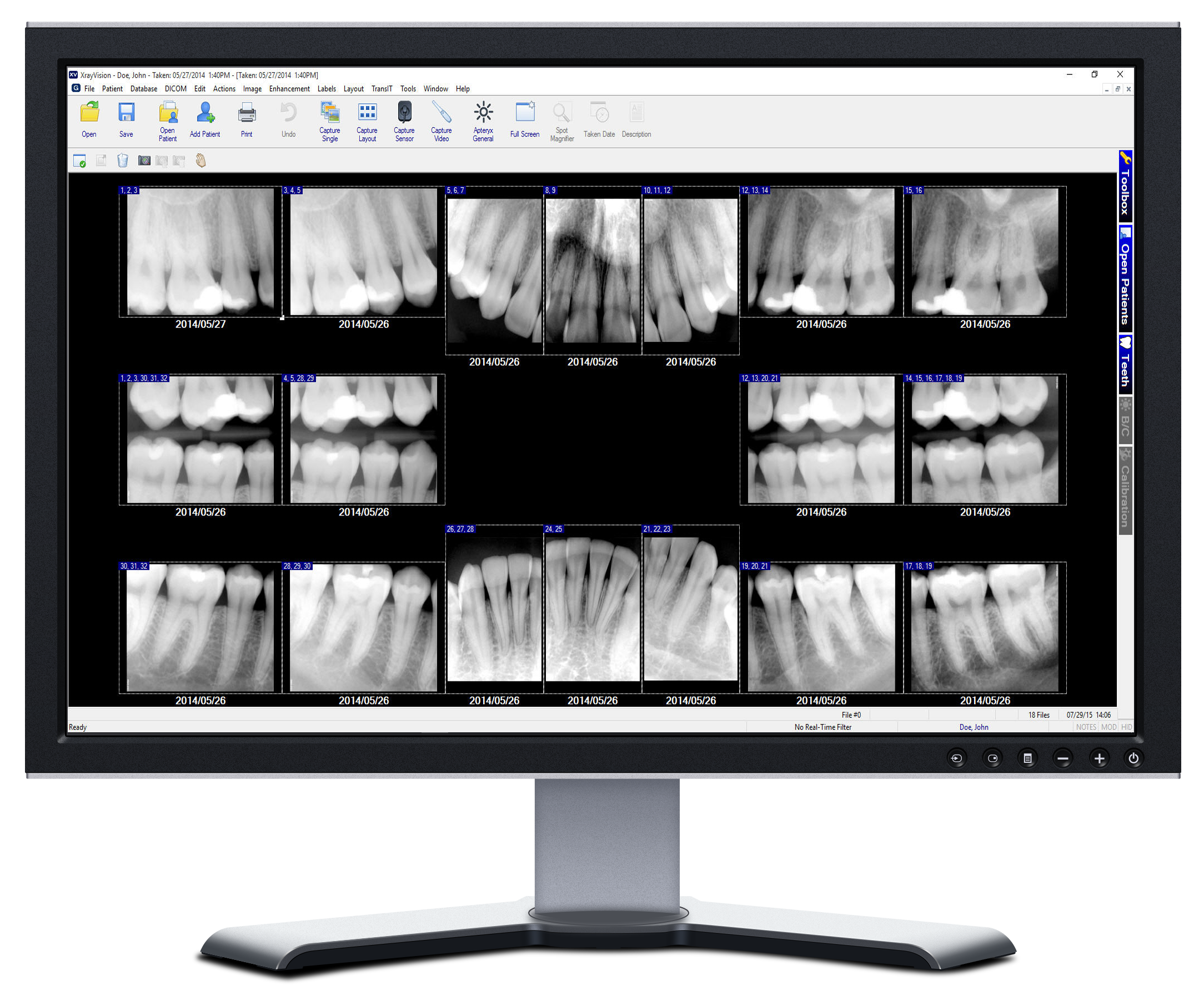 ApexCloud Imaging Software - DentalSensors.com