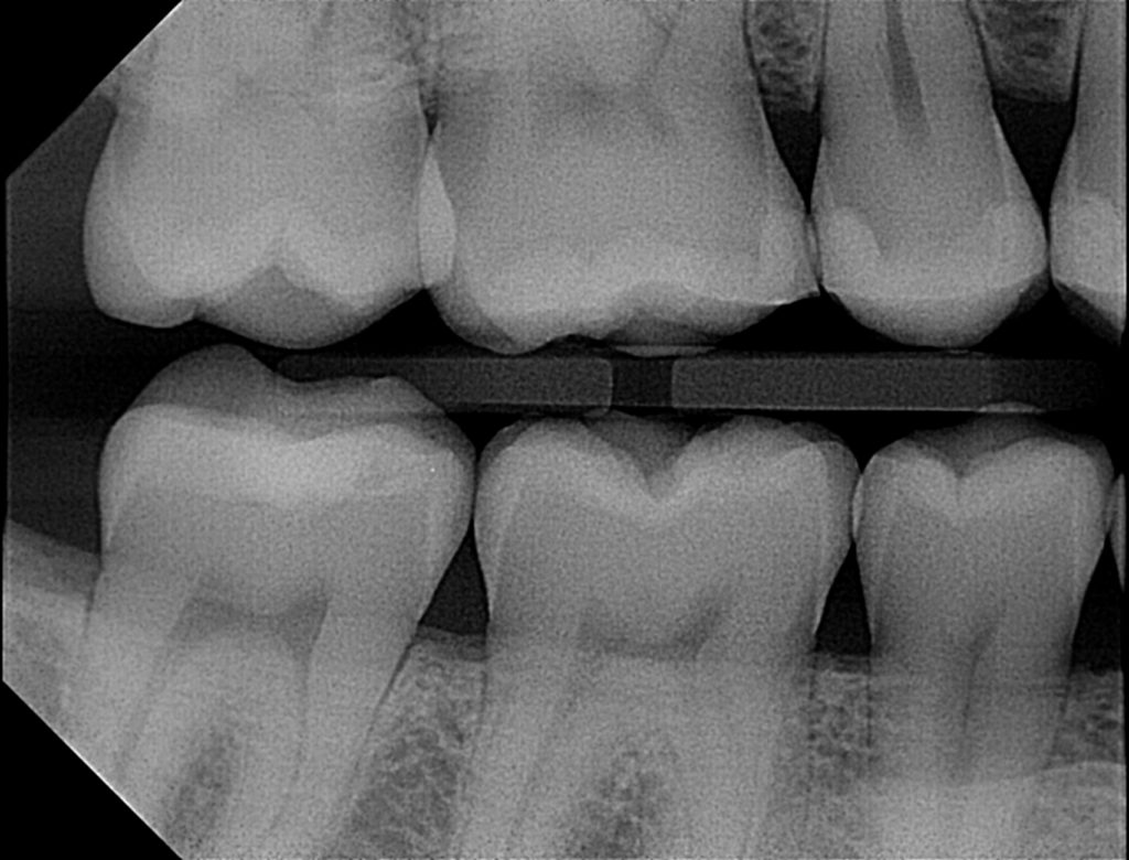 Apex Sensor Compatibility with Imaging Software