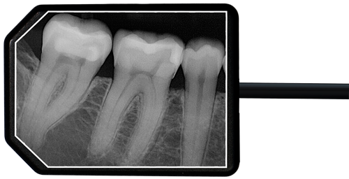 Apex Dental Sensors X-ray