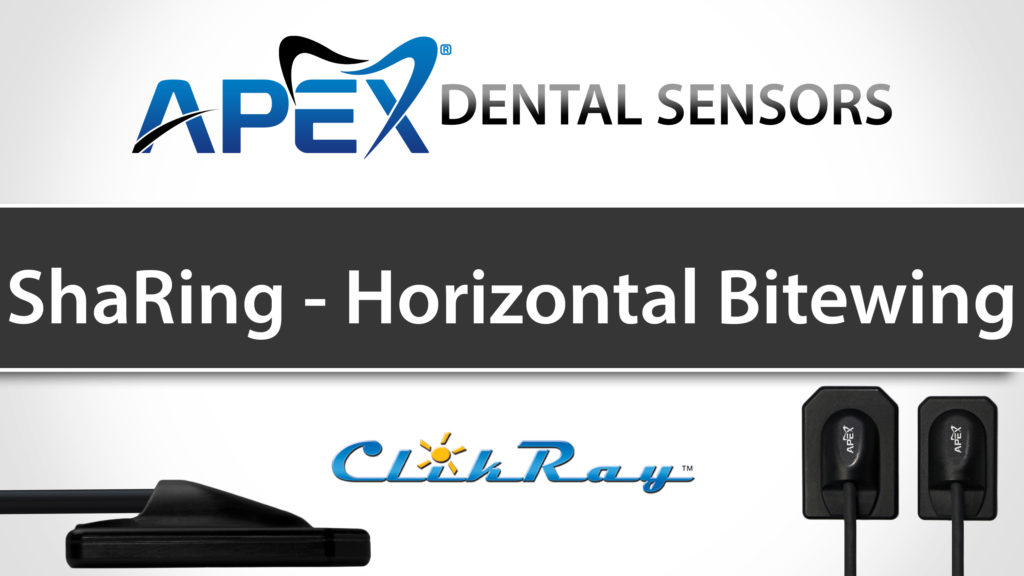 SharRing Positioning - Horizontal Bitewing