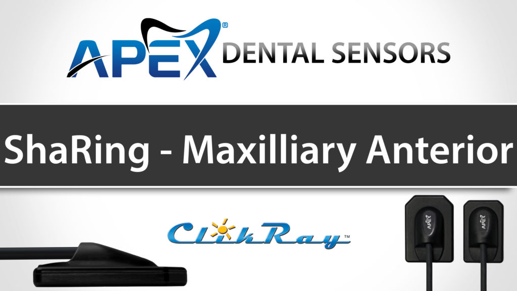 SharRing Positioning - Maxilliary Anterior