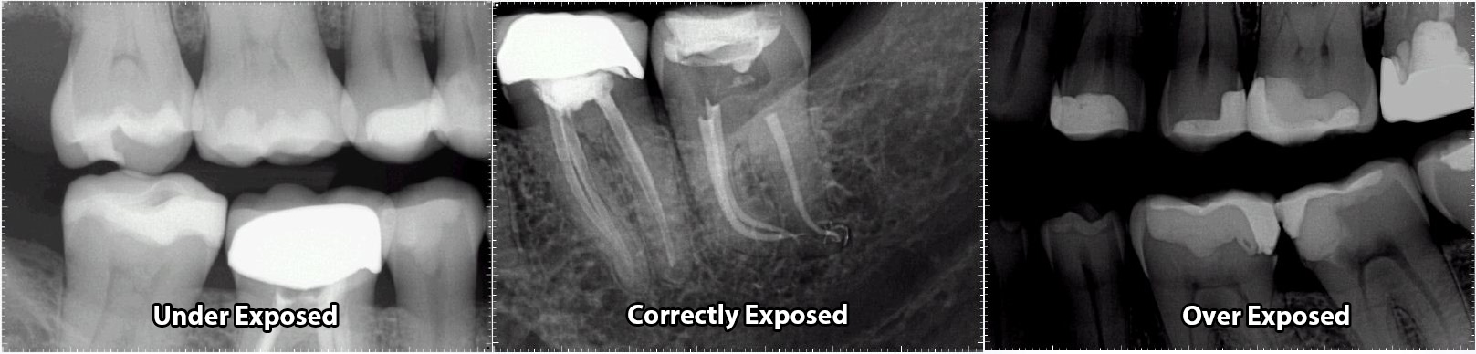 exposure to x ray